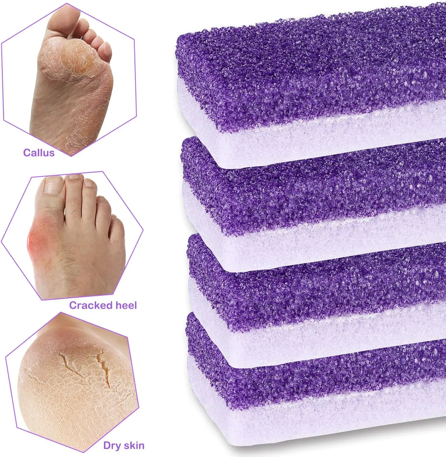 2/4 Stuks Voet Puimsteen Voet Bestand Eelt Dode Huid Remover Voet Hak Scrubber Gladde Voeten In seconden Pedicure Peeling Tool