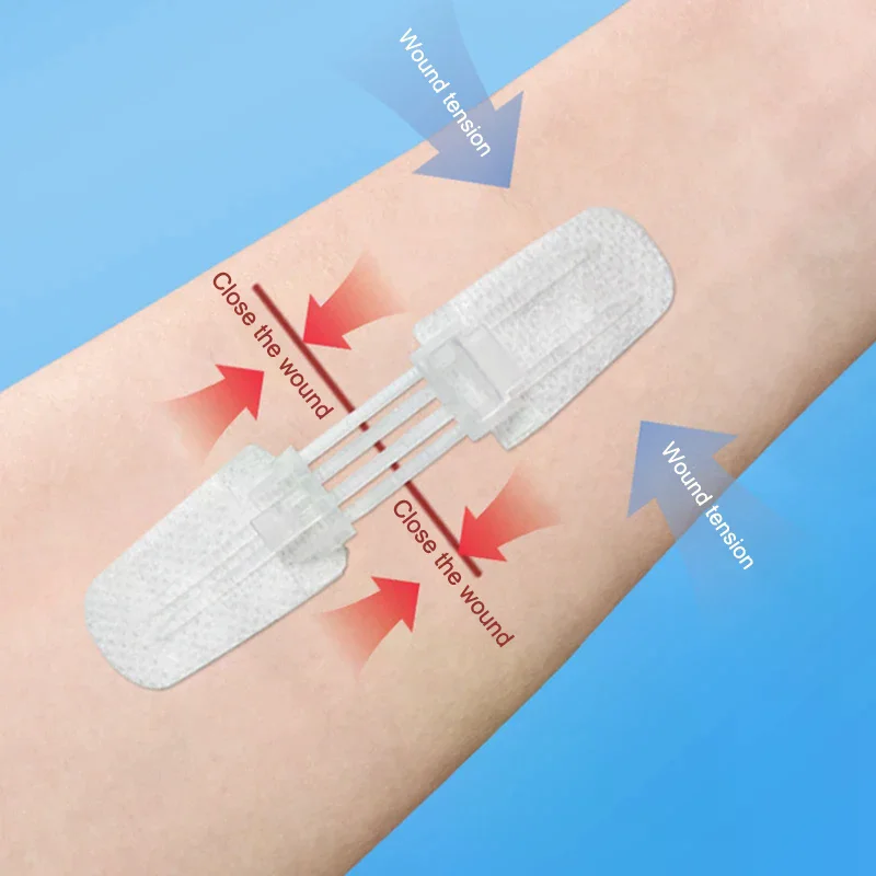 

Zipper Band-aid Painless Wound Closure Patch Suture-free Wound Dressing Patches Zip Suture Reducer Band Aid Outdoor Portable