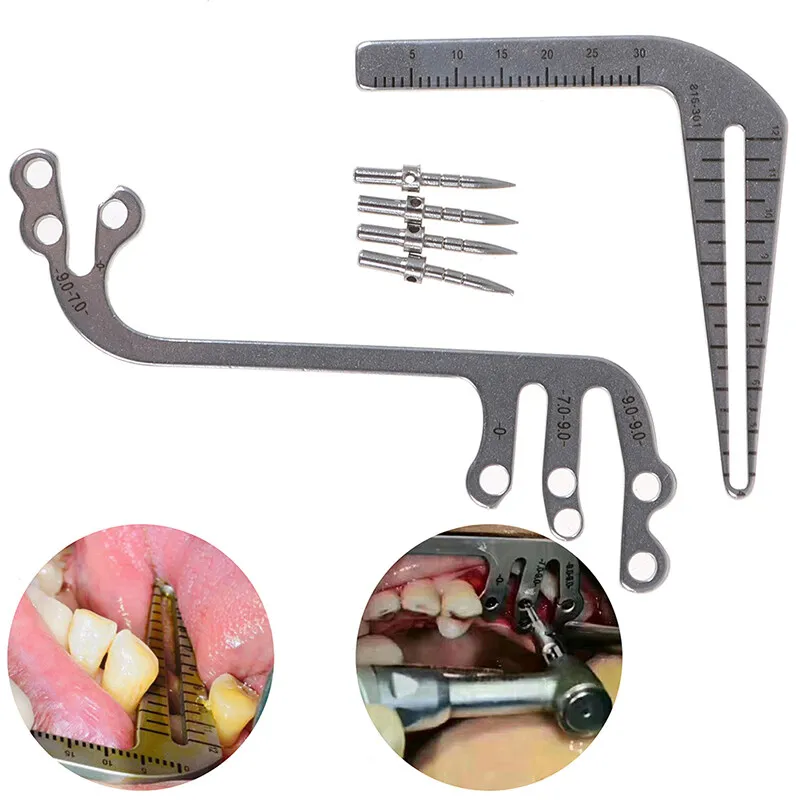 مجموعة لوحة دليل زرع الأسنان، محدد موقع الزرع، لوحة دليل تحديد المواقع، مسطرة تحديد المواقع #1