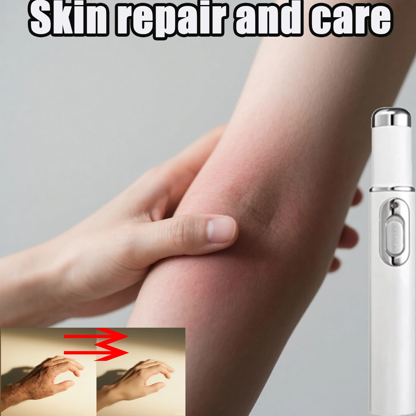 

Новая терапевтическая лазерная ручка можно использовать для лечения отеков и зуда кожи, чтобы облегчить дискомфорт кожи. Спрей для ухода за кожей.