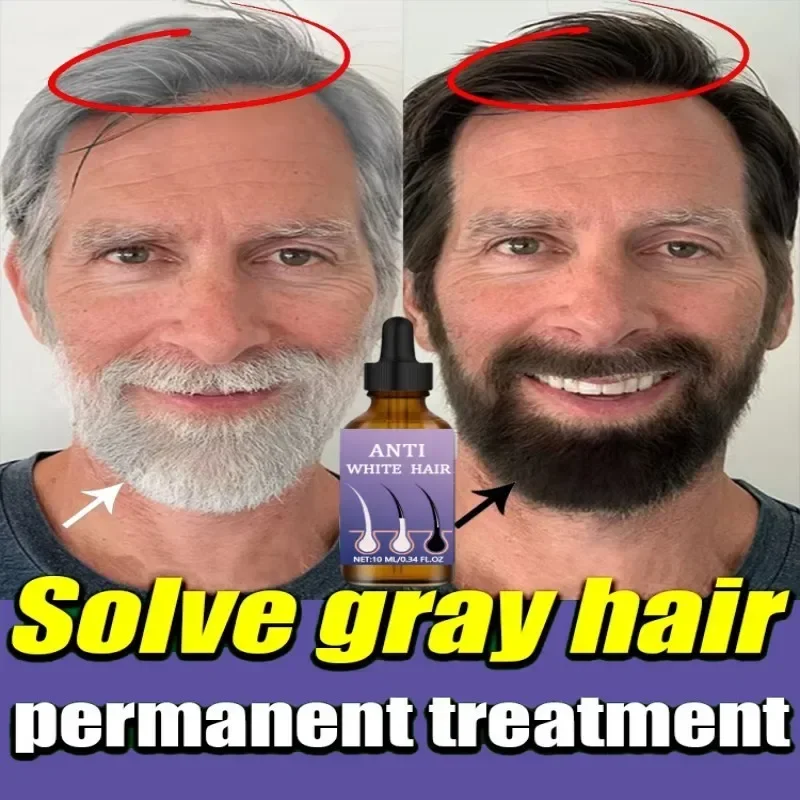 

Natural Anti Gray Hair Serum - Repair White & Darkening Hair | Nourishing Hair Care Remedy