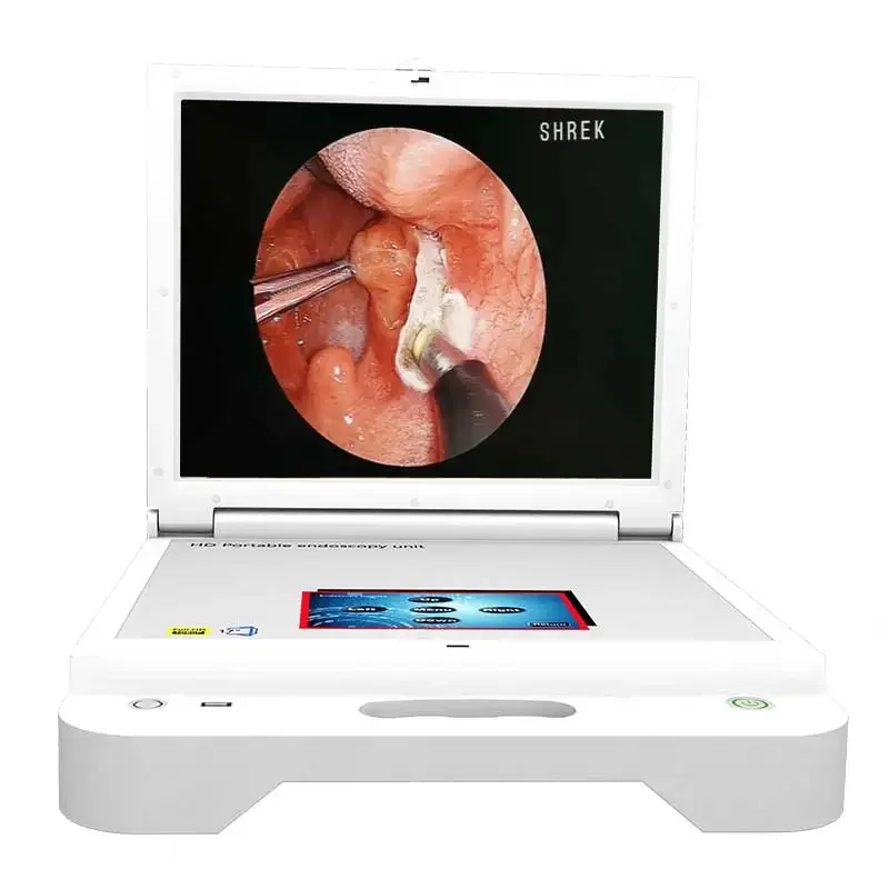 portable FULL HD medical video endoscopy for hysteroscopy equipment and ent instruments