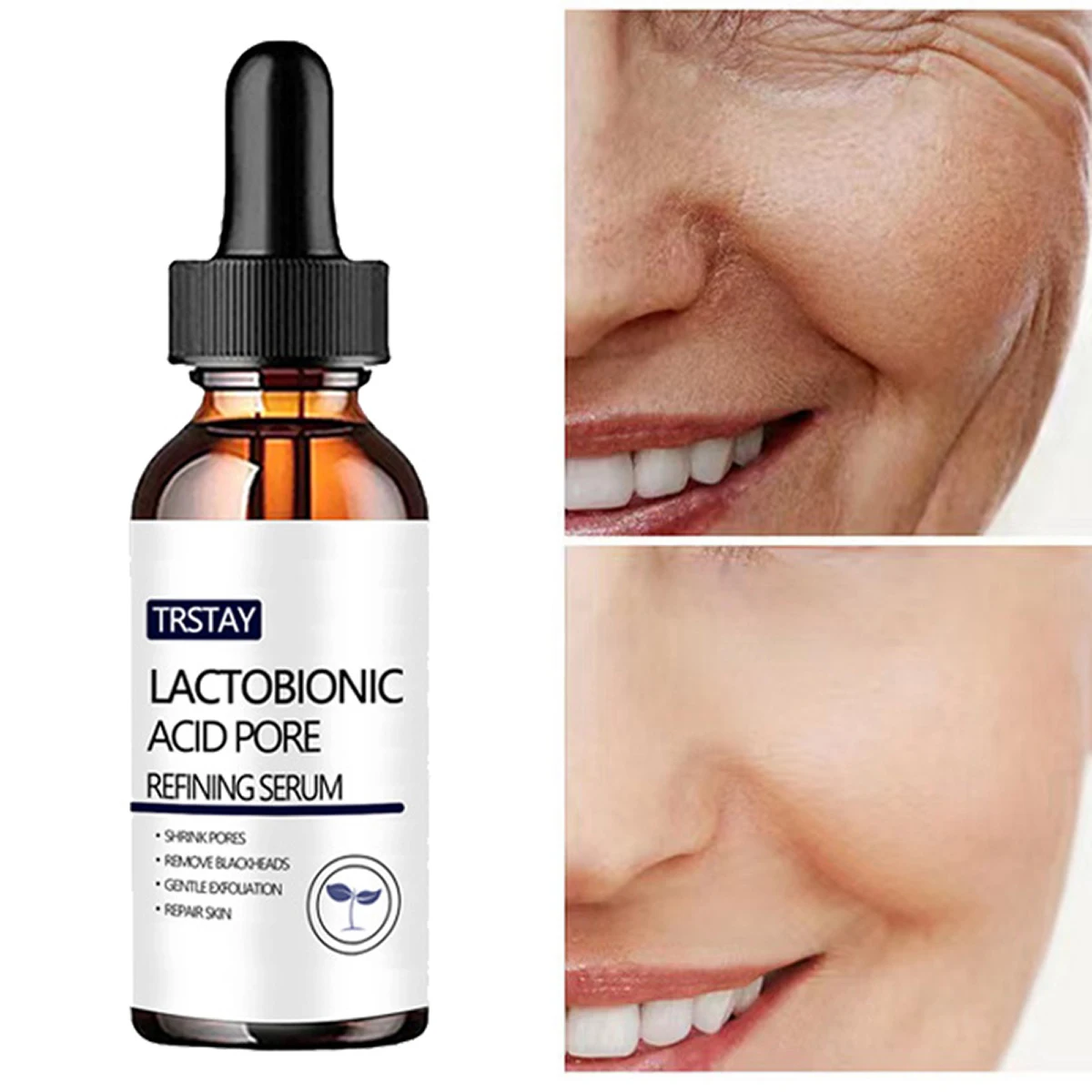 Die Porenreinigungsessenz mit Milchsäurebakterien kann Flecken, Poren verkleinern, Hautfarbe aufhellen und Öl kontrollieren