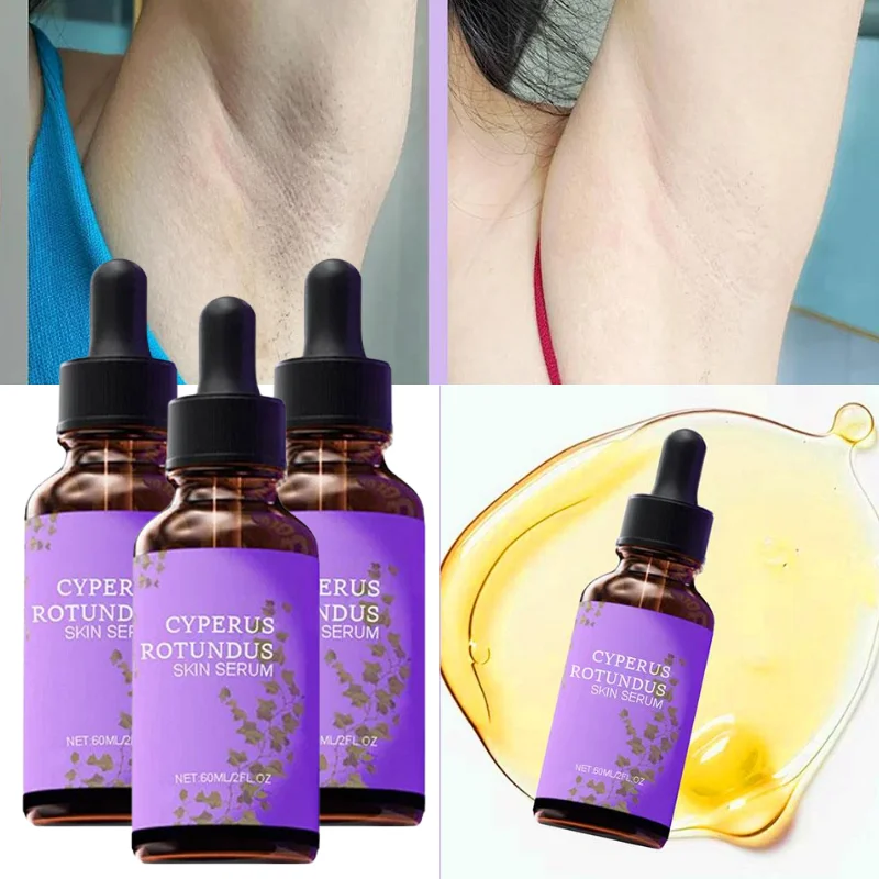 60ml Body Oil for Hair Removal Prevent Hair Growth Dark Spot Corrector for Armpit Knees Elbows Skin Care Serum Even Tone