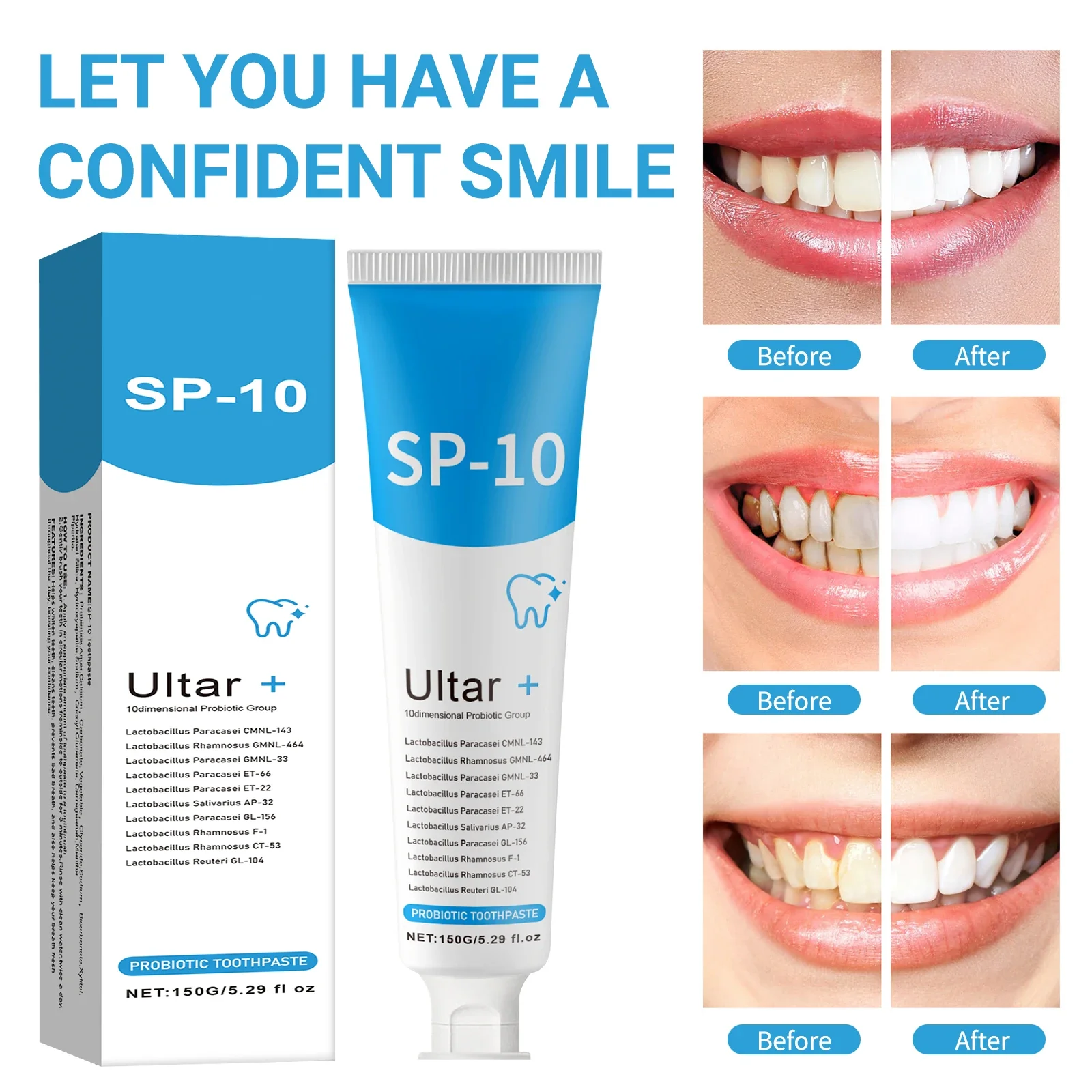 

150 г SP10 пробиотическая отбеливающая зубная паста, очищающая пятна на зубах, удаление неприятного запаха изо рта, уменьшение налета, предотвращение пародонтита, уход за зубами