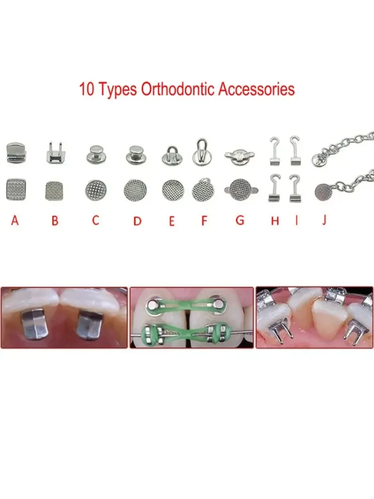 11 Types de boutons linguals dentaires en métal, groovibles, monobloc, taquet de Traction, œillet, chaîne, accessoires orthodontiques