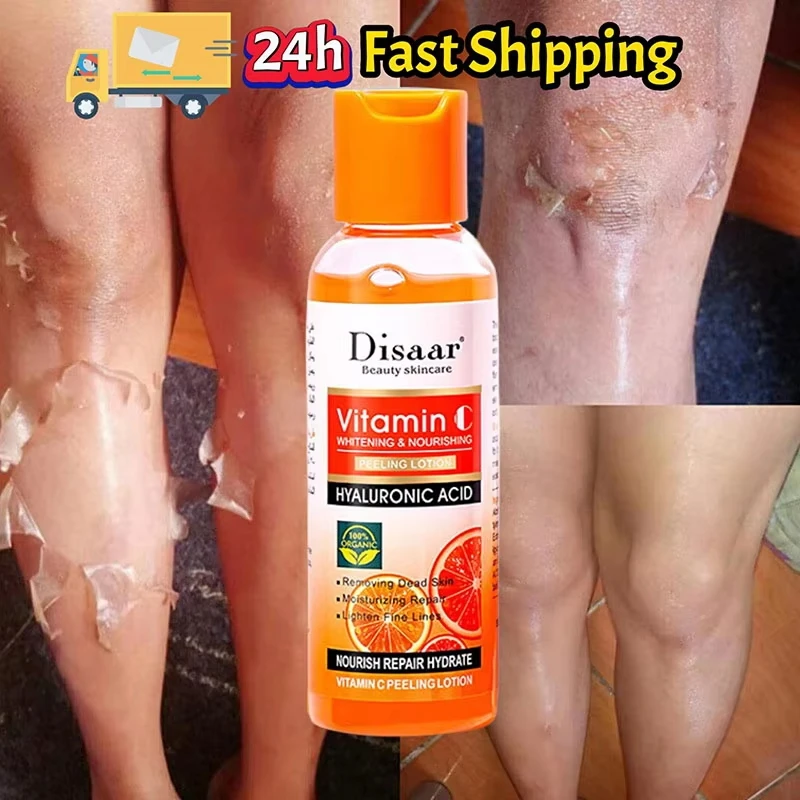 

Yellow Powerful Deep exfoliating Oil Removes Dead Skin Elbows Knees Black Fingers Joints Removes Melanin Brightens Body Care