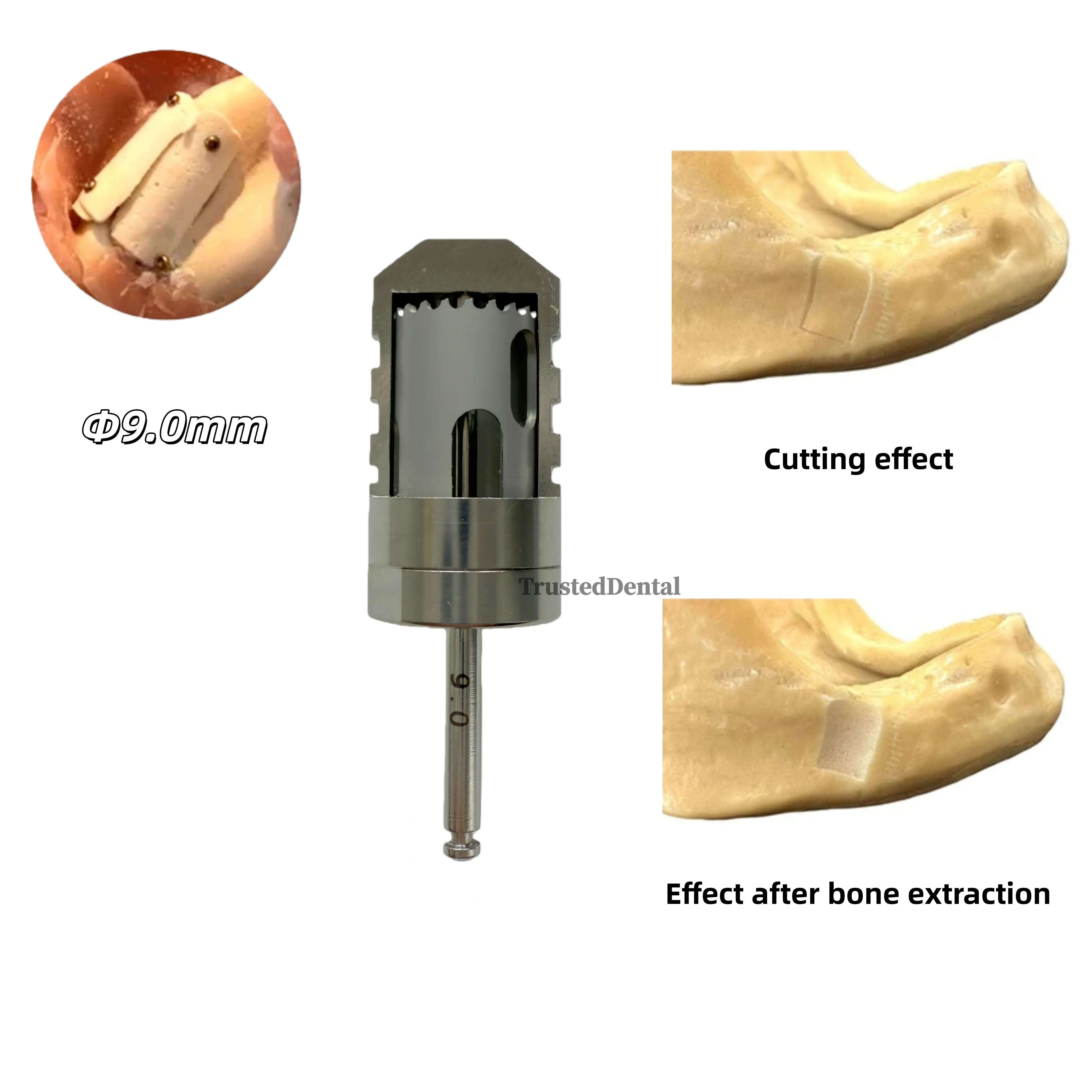 taladro-de-muestreo-de-hueso-de-medio-mes-dental-injerto-de-hueso-perforacion-de-rebanadas-de-hueso-taladro-de-anillo-para-implante-dental-Φ90mm