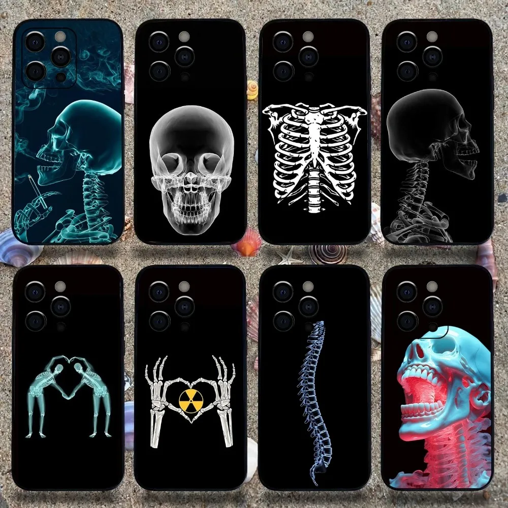 Radiological Human Organs Skeleton Phone Case For Apple iPhone 15,14,13,12,11,Pro,X,XS,Max,XR,Plus,Mini Soft Black Cover