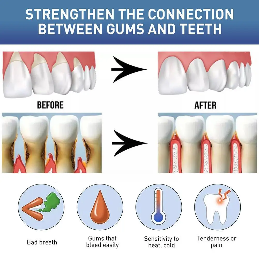 Gum Soothing Gel Relieves Gum Pain Whitening Teeth Stains Essence Tools Removes Dental Hygiene Cleaning Toothpaste I2R4