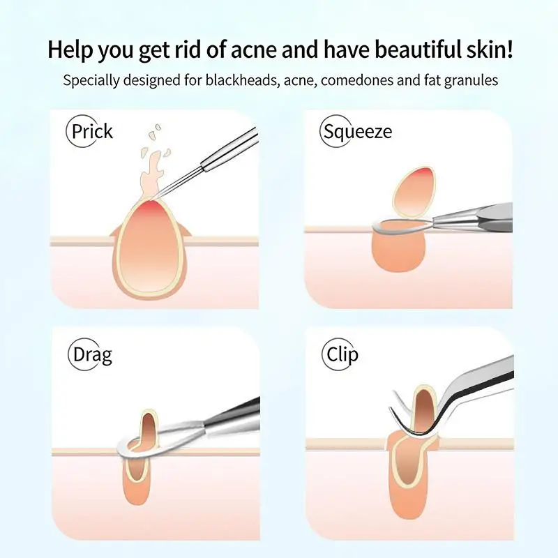 Professional  and Blackhead Tools Ultra Precise  Removal Tweezers Set for Deep Clean Pore Care