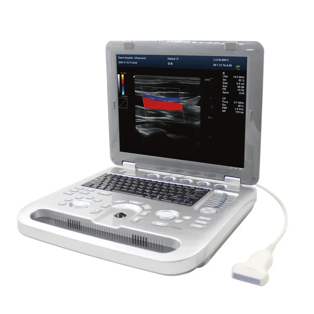 

Best Price Veterinary Portable Doppler Veterinary Ultrasonography Vet Ultrasound Machine