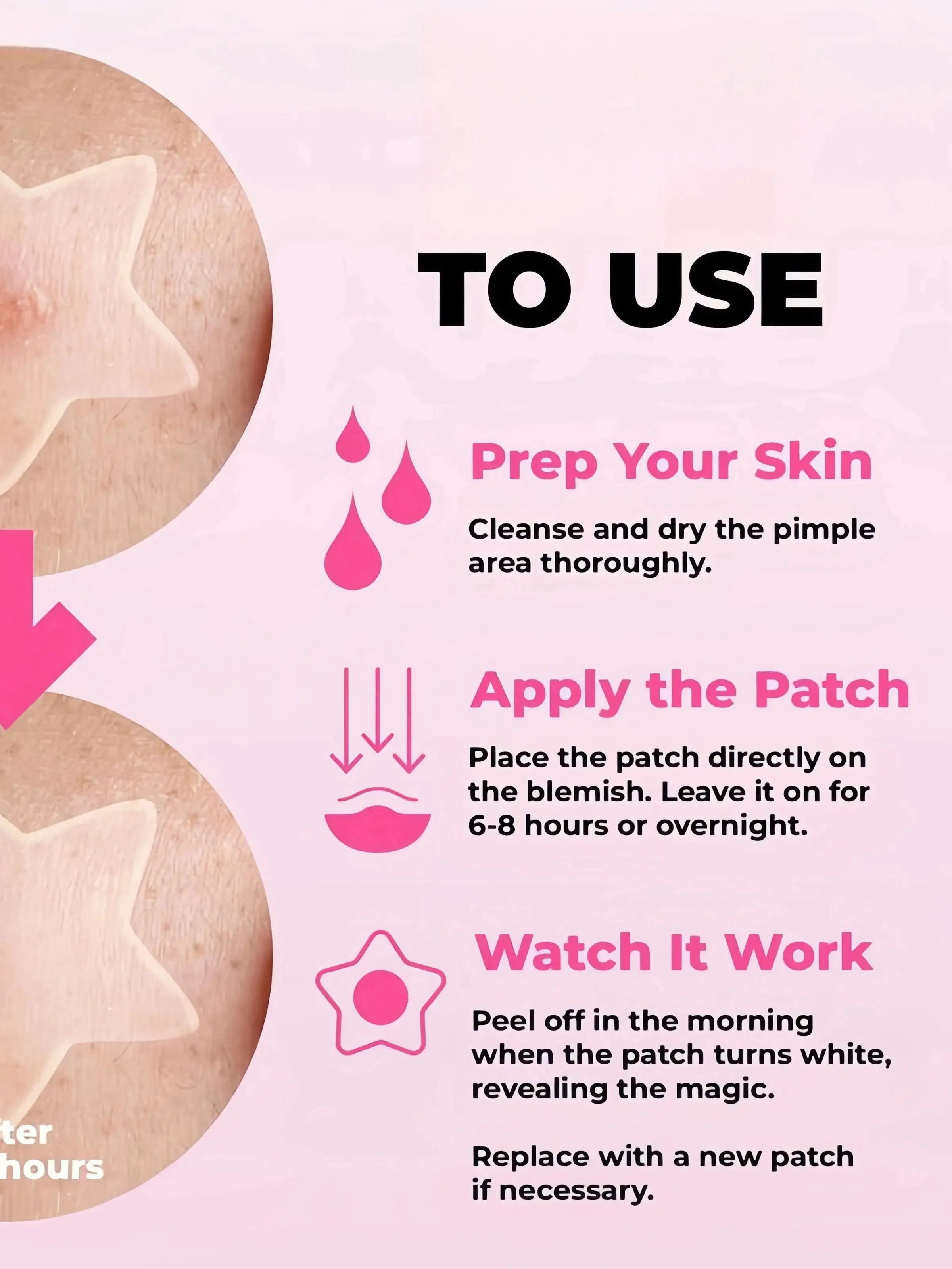 200 قطعة من رقع حب الشباب على شكل نجمة لطيفة وغير مهيجة، تغطي عيوب حب الشباب وهي مقاومة للماء وقابلة للتنفس