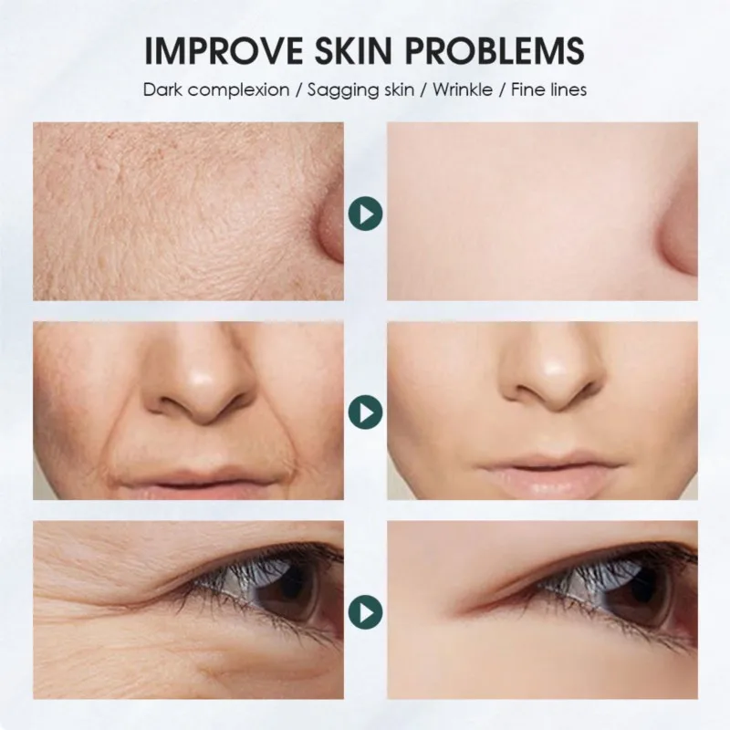 EMS micro current high-frequency vibration massage facial anti wrinkle skincare device anti wrinkle induction device