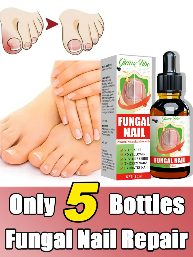 

Onychomycosis nail treatment serum, prevent onychomycosis nail infection, treat toe fungus