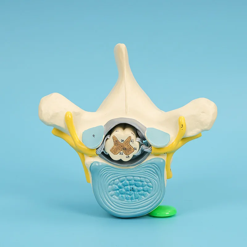 نموذج تكبير الحبل الشوكي للعمود الفقري والعمود الفقري، نموذج طبي للحبل الشوكي الصدري