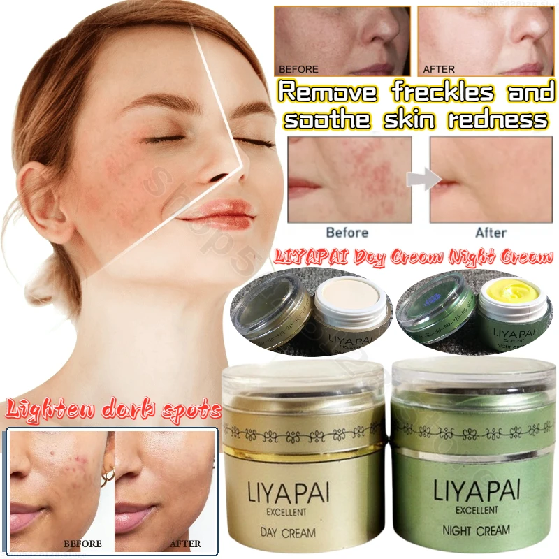 

LIYAPAI Day Cream and Night Cream Fades Spots and Soothes Sensitive Skin Cream Effective Anti-freckle Skin Care15ml