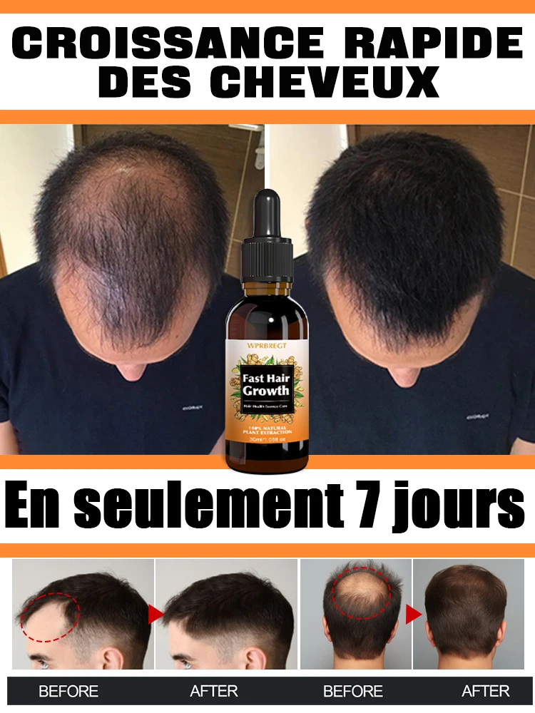 Hot selling product, 99% of buyers buy again, have more and more hair, say goodbye to baldness, thick hair