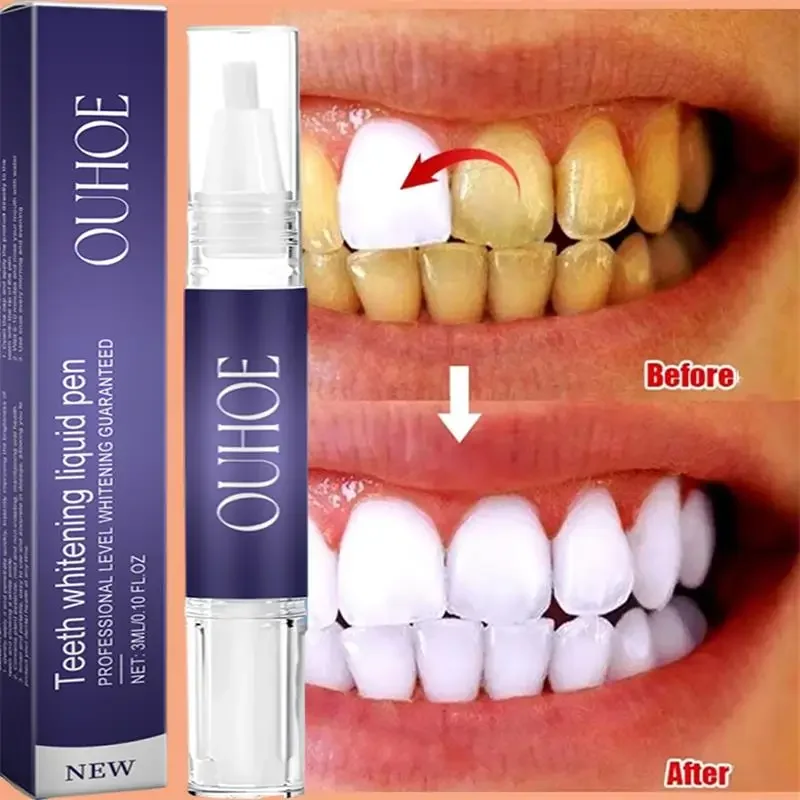 Fast Teeth Whtening Toothpaste Pen Remove Plaque Stains Cleaning Oral Hygiene Bleaching Dental Tools Fresh Breath Tooth Care