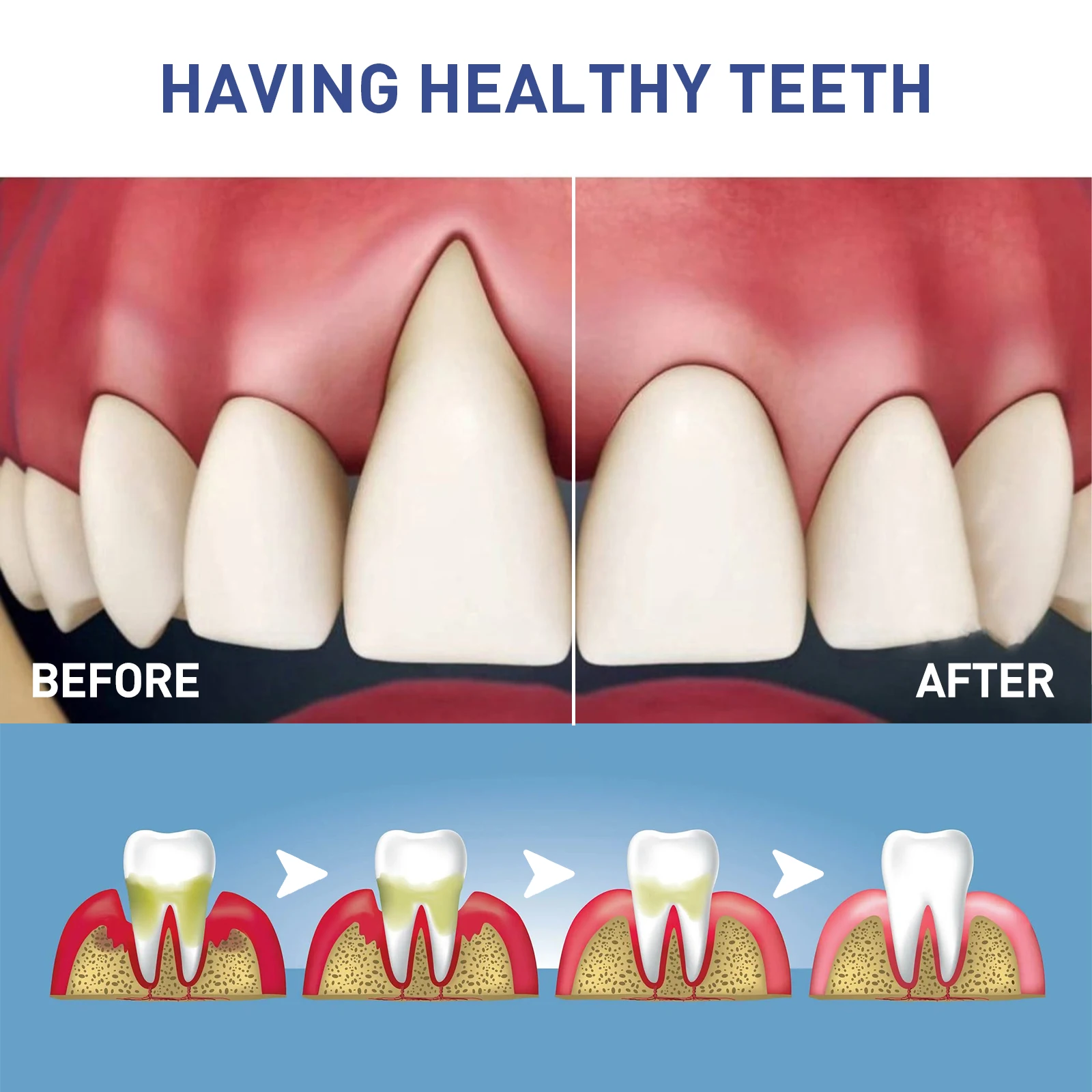 60ML Damaged Gum RepairCare Gel Serum Relieve Sore Gums Allergy Deep Cleaning Teeth Stains Tartar Serum Dental Caries Toothpaste