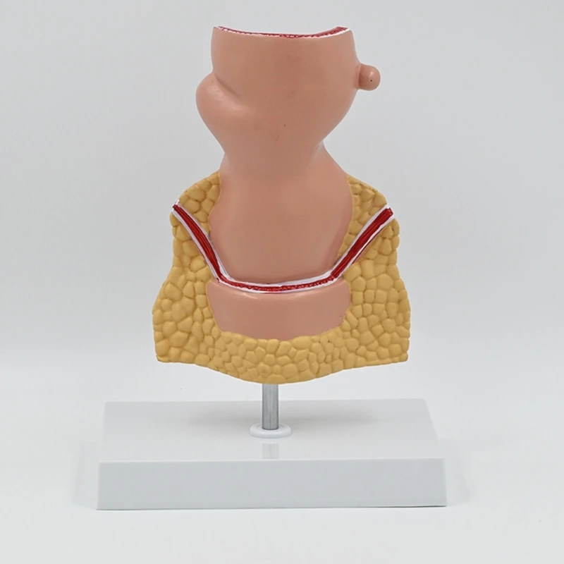 Модель человеческих патологий прямой кишки Модель прямой кишки человека Модель обучения медицине