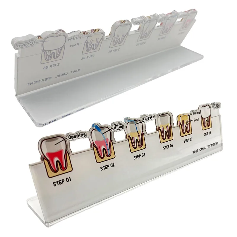 Dental Root Canal Treatment Flowchart Stand Endodontic Process Guide Dental Lab Study Teaching Demonstration Model Dentist Gift