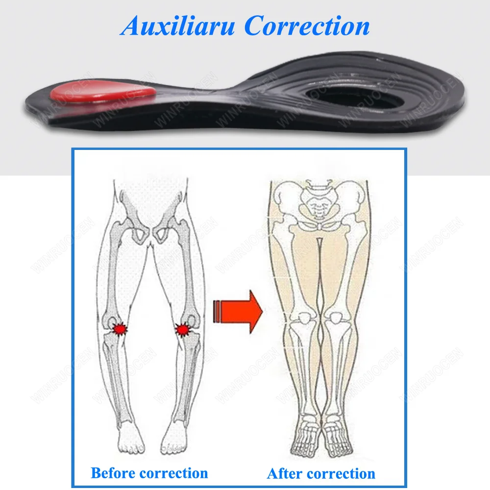 Flat Foot Massaging Cure Corrector Gel Insole O/X Type Leg Arch supports Feet Pain Care Varus Orthopedic Correct Shoe Insoles