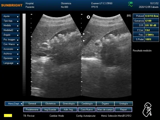 Black and White Laptop Human Ultrasound Scanner For Sale Cheapest Portable Full Digital Ultrasound Machine