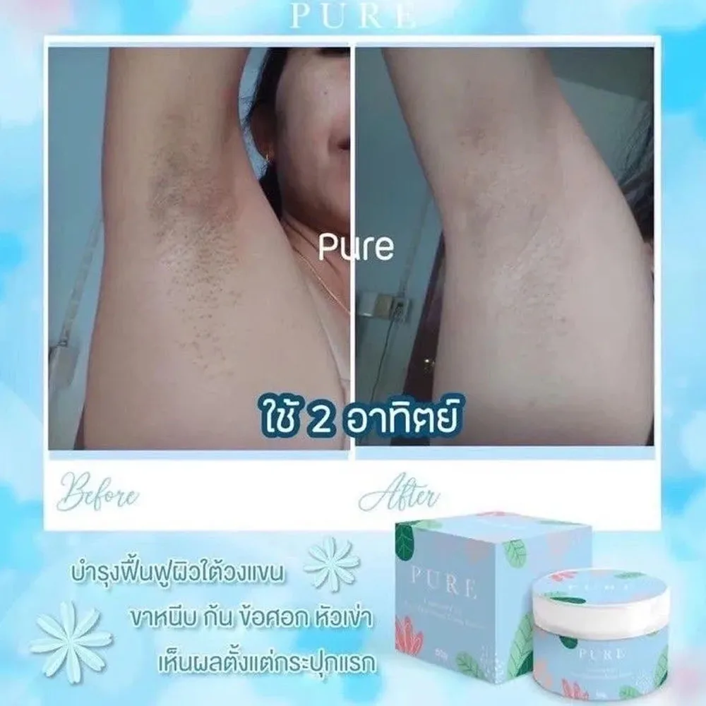 Pure Underarm Body Skin Care Armpit White Smooth, Fade Dark Spots Groin Buttocks Dark Elbows Reduce Stretch Marks 50g Bottle