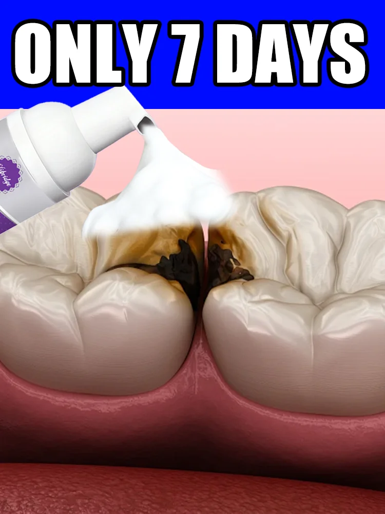 

New upgrade 3.0 Teeth cleaning care tools,oral foam,free shipping