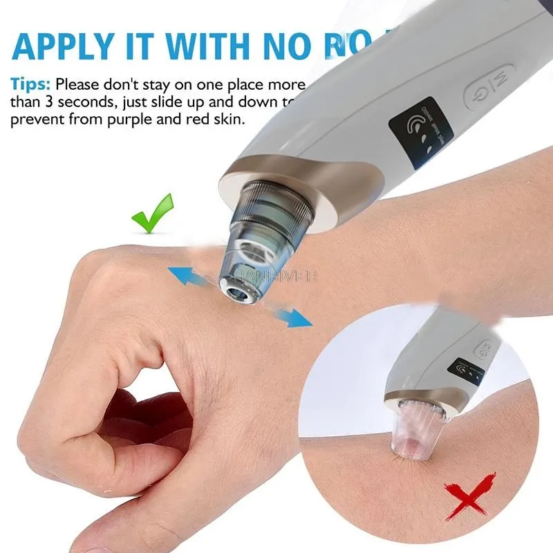 Blackhead Remover Vacuum Acne Pimple Black Spot Suction Electric Facial Pore Cleaner Skincare Exfoliating Beauty Instrument
