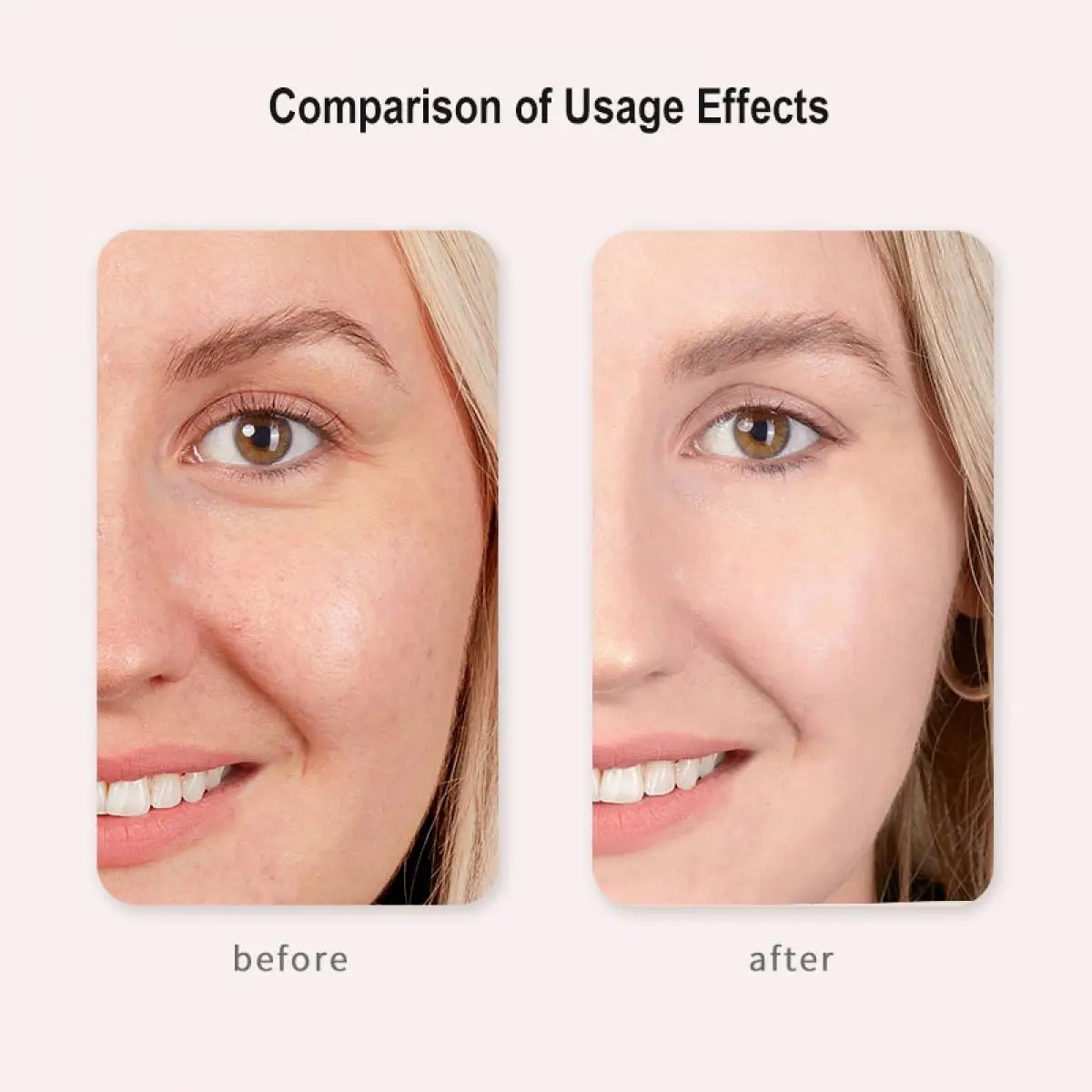 HIFU FacialDefy 3.0 Lite 2 in 1 Eye & Facial Microfocused เครื่องอัลตราซาวนด์นวดกระตุ้นการผลิตคอลลาเจนลดริ้วรอย