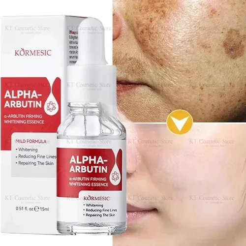 Removedor de manchas oscuras, suero blanqueador para cara, pecas, melanina, corrección, Reduce las líneas finas, ilumina la esencia, belleza coreana, cuidado de la piel