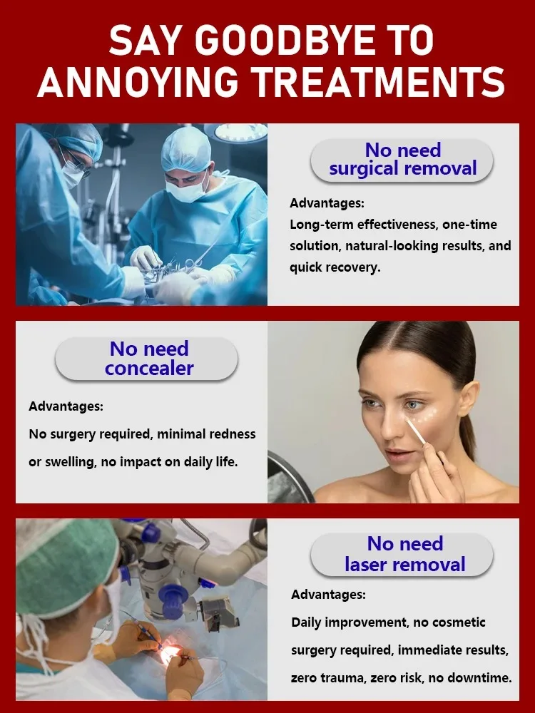 3차 주름 제거 아이크림 눈가 다크서클 붓기 완화 탄력 크림 눈 밑 미백 잔주름 보습