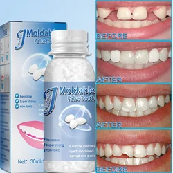 30ml plástico resina temporária dente reparação grânulos dentadura dentes adesivos lacunas quebrado moldável sólido cola dental beleza ferramentas