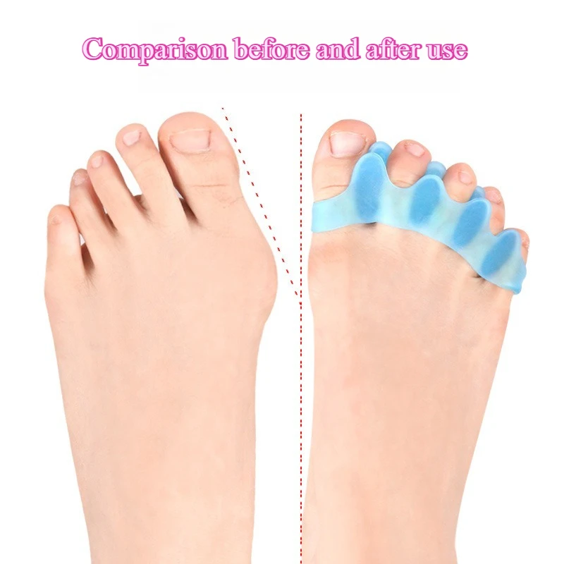 1Pair Silicone Toe Separator Hallux Valgus Corrector Bunion Orthotics Protector Pain Relief Forefoot Pad Sock Foot Care Pedicure