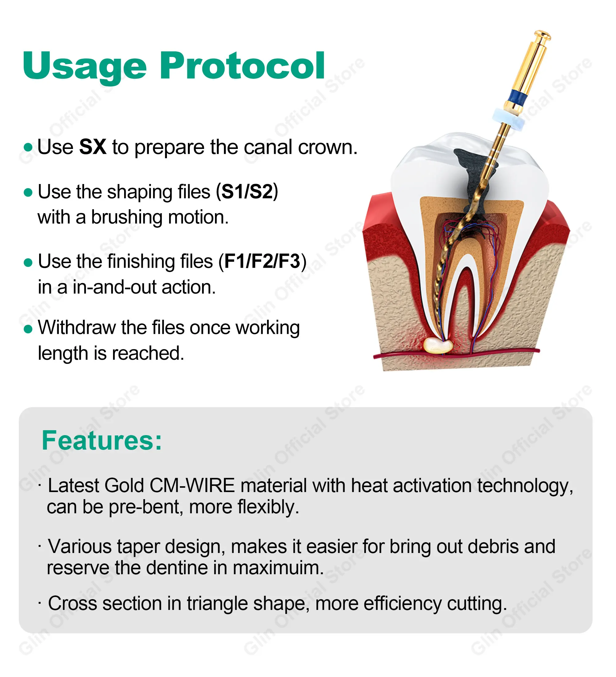Glin Dental Endodontische Feilen 19/21/25/31mm F3 F4 F5 Gold Flexible Feilen Wärmeaktivierbare Endo-Wurzelkanal-Rotationsfeilen Goldene Feilen – Detail 6