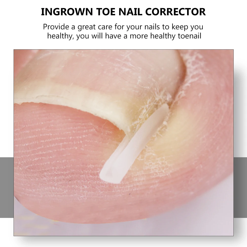 

Ingrown Nail Corrector Toenails Adjuster Tools Stainless Steel Pedicure Paronychia Care Tool Nail Correction Accessory Healthy
