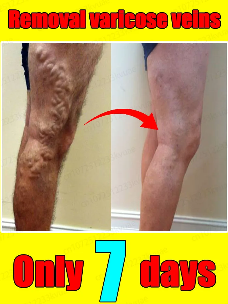 Hᴇᴀʟᴛʜʏ ʟᴇɢs ᴍᴀᴋᴇ ʏᴏᴜ ғᴇᴇʟ ᴄᴏᴍғᴏʀᴛᴀʙʟᴇ ɴᴏ ᴍᴀᴛᴛᴇʀ ʜᴏᴡ ʏᴏᴜ ᴍᴏᴠᴇ