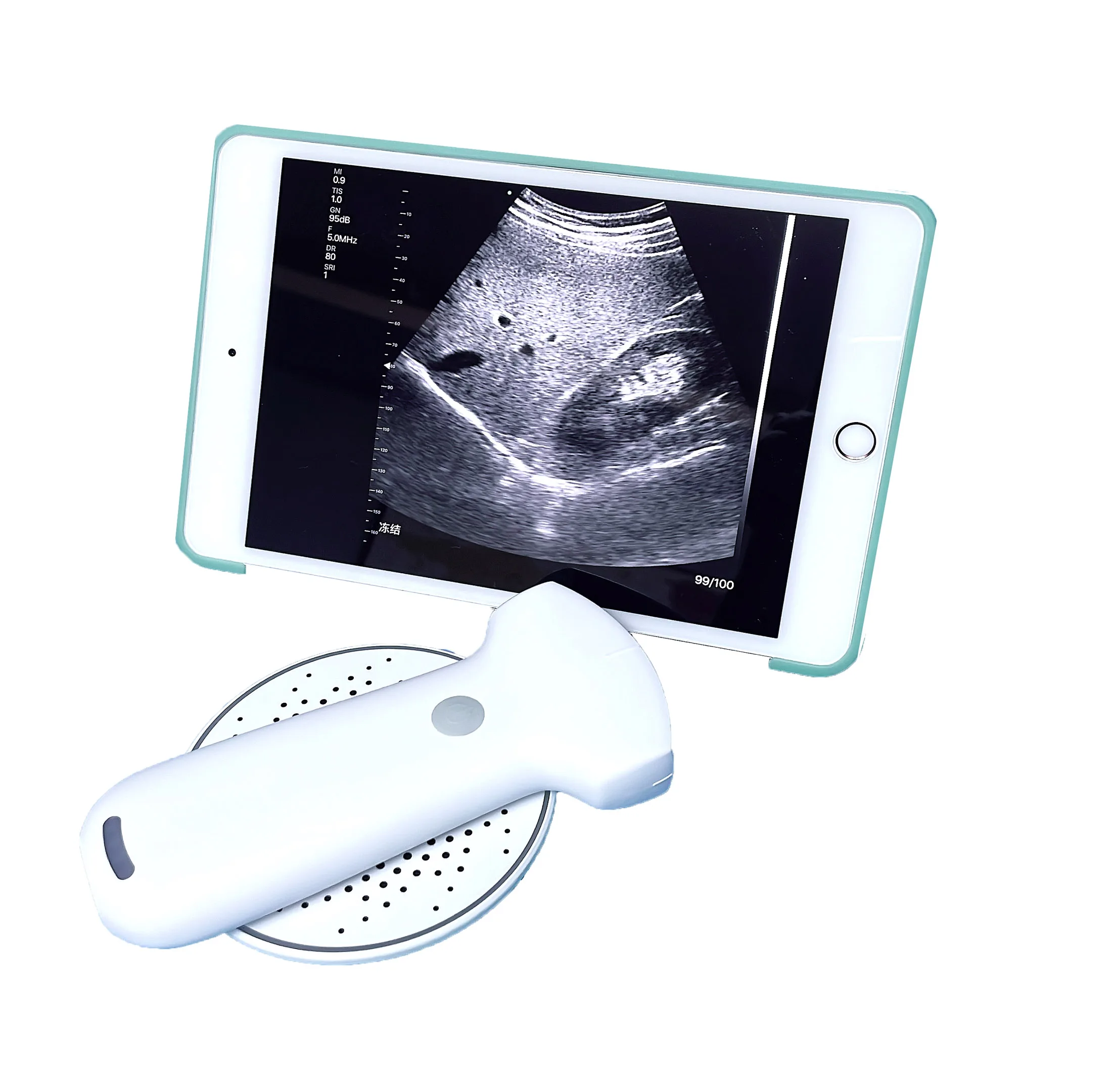 MSLPU94 192 elements Wireless Portable(Handheld) Color Doppler Ultrasound Probe Convex probe