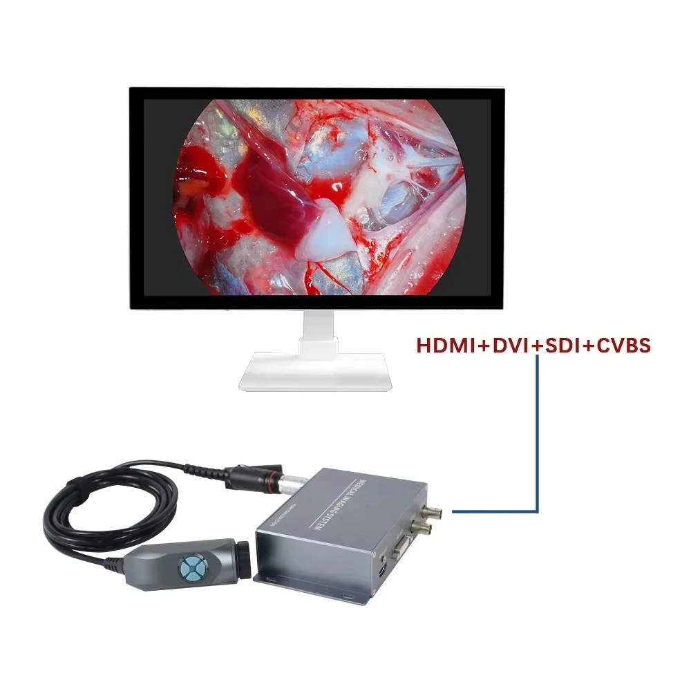 Factory Price Small Endoscopy Silver Processor Camera Portable Endoscopes ENT Endoscopy Laryngoscopy Veterinary