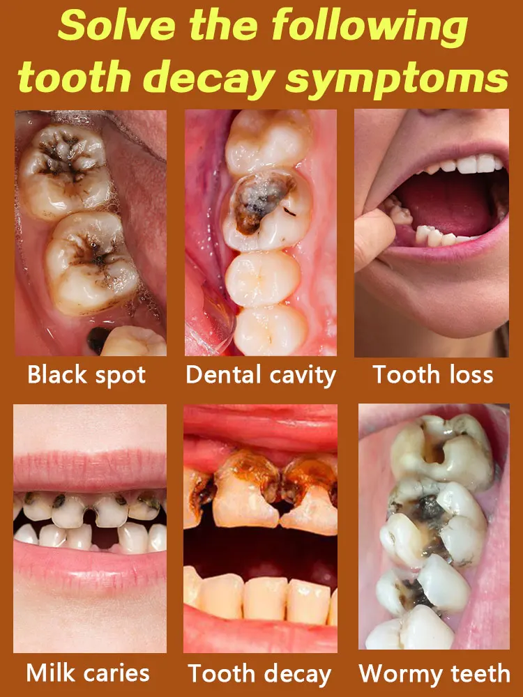 Solve teeth decay problem