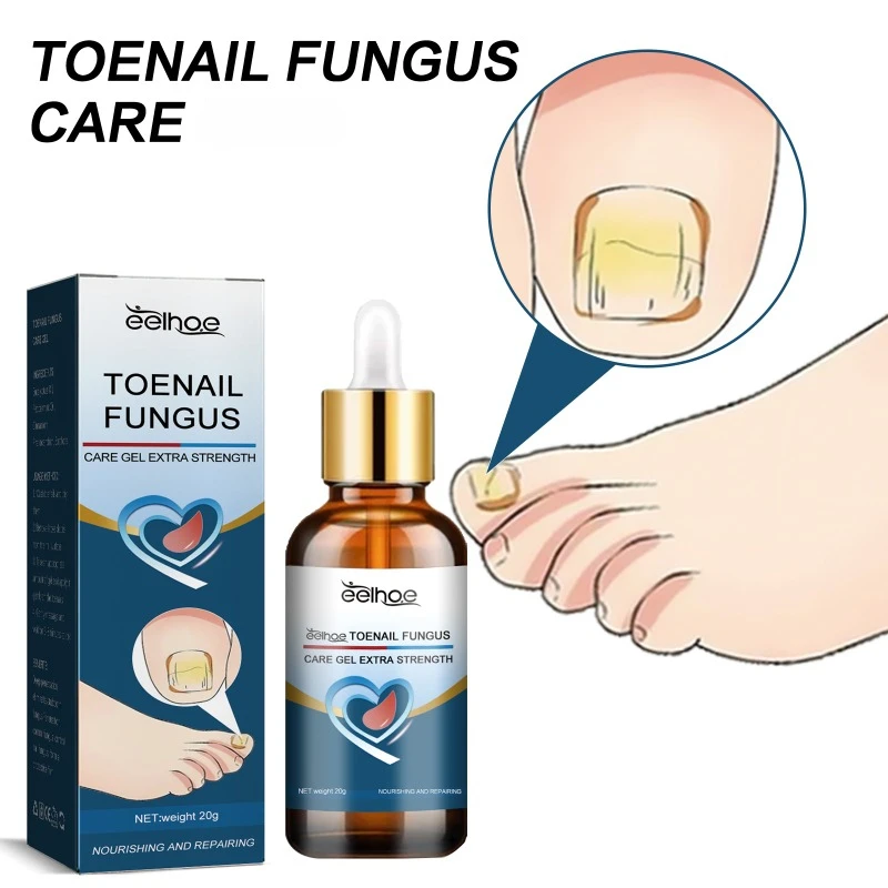 Toenail Fungus repair essence Treatment onychomycosis hand feet fungal Anti-infective Paronychia soft nails thickening nail Gel