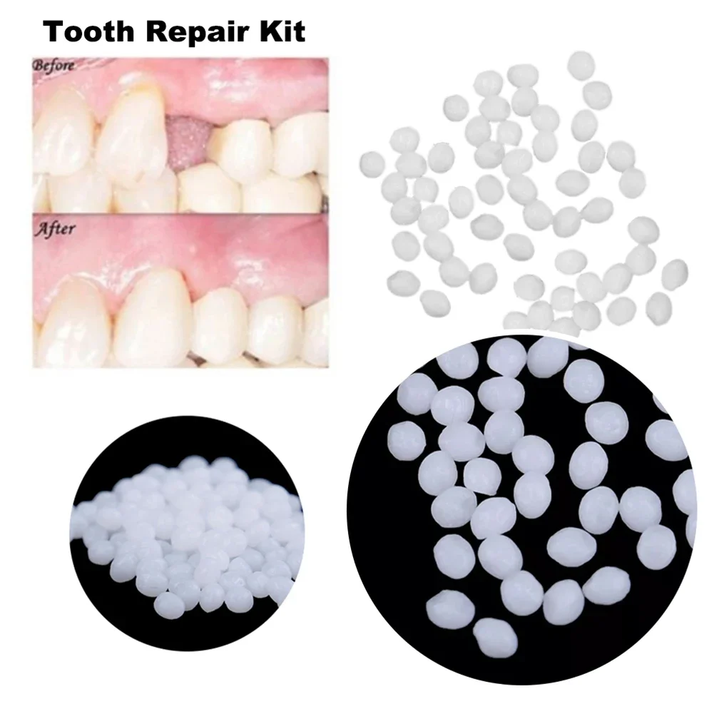 Sdotter 10g/100g Teeth And Gap Falseteeth Solid Glue Resin Denture Adhesive Teeth Dentist FalseTeeth Solid Glue Temporary Tooth