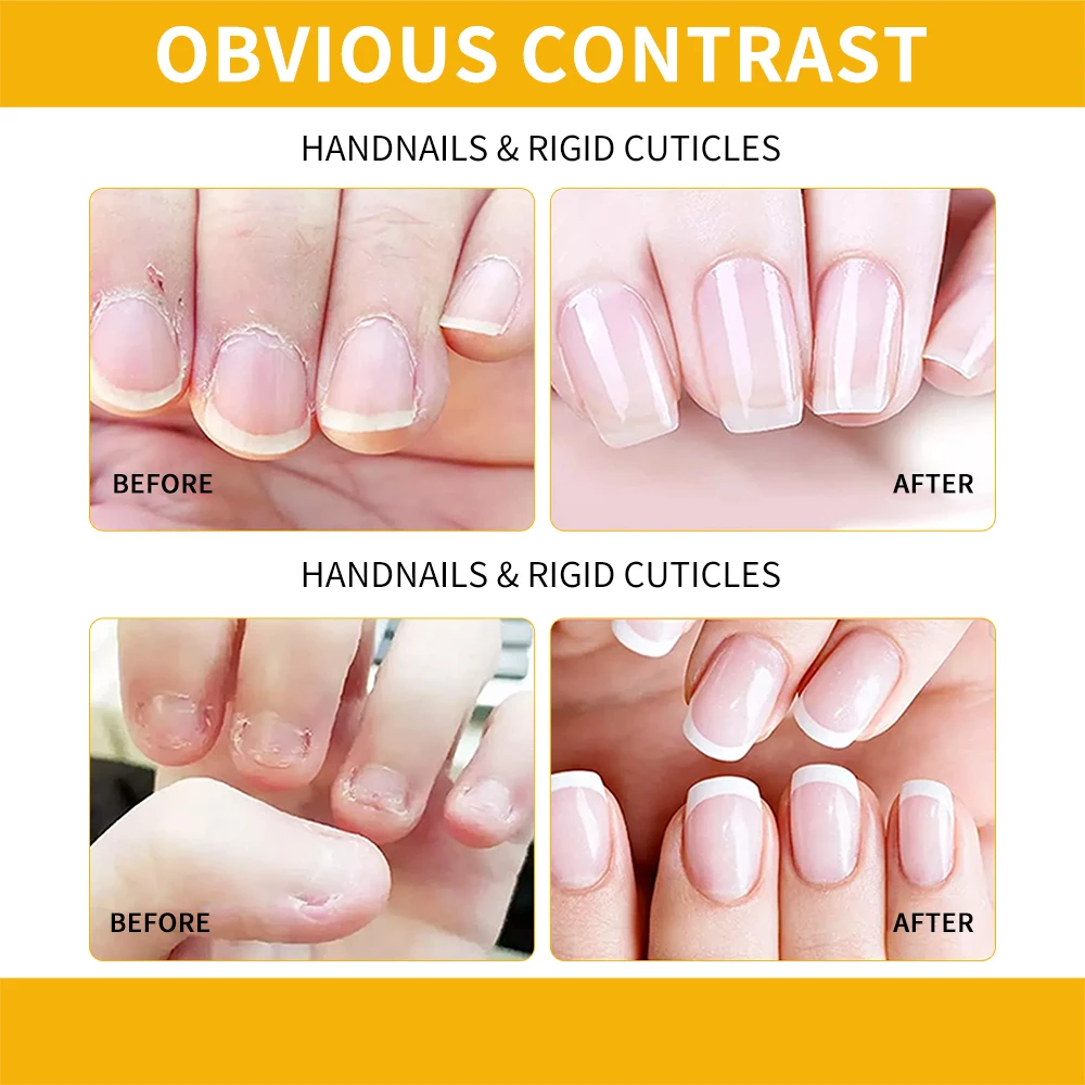 Olio rivitalizzante per cuticole EJW - Olio idratante per cuticole riparate - Rimedio per pelle danneggiata e unghie sottili - Latte e miele