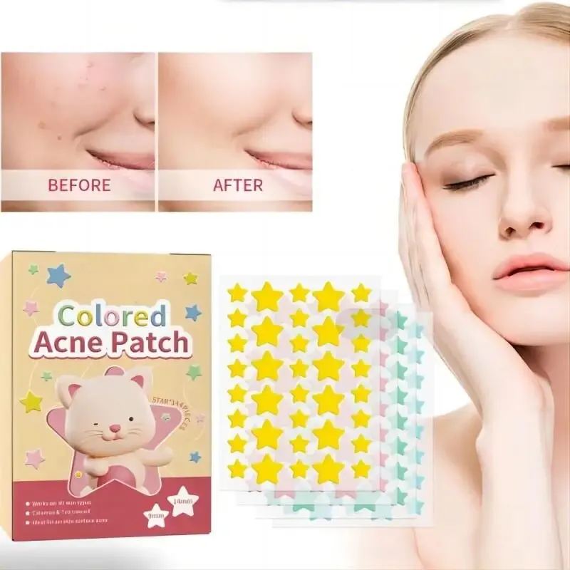 144pcs Star Acne Patch Fade Away Pimple Marks Acne Clean Pore Smooth Skin Portable Colorful Pentagram Acne Patch