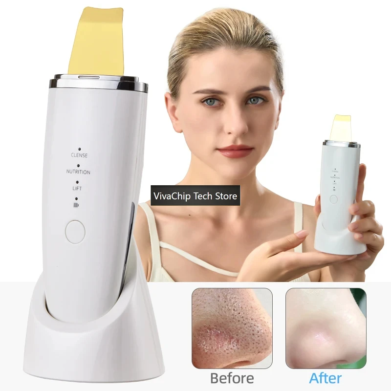 VivaCTProfessional Ultrasonic Facial Skin Scrubber Vibration Face Spatula Blackhead Remover Shovel Clean Cavitation Peeling Mach