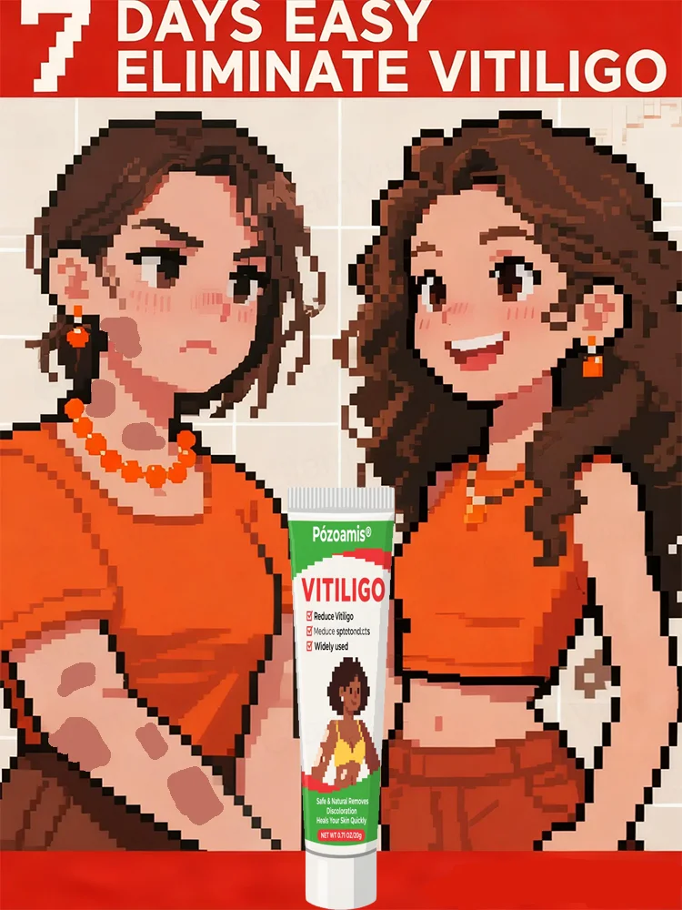 Gewoon een lichte aanraking kan vitiligo verwijderen en de gezonde huid herstellen