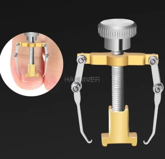 Ingrown Toe Repair Nail Pedicure Foot Care Tool Corrector Professional Paronychia Chiropody Podiatry Repair Nail Treatment Tools