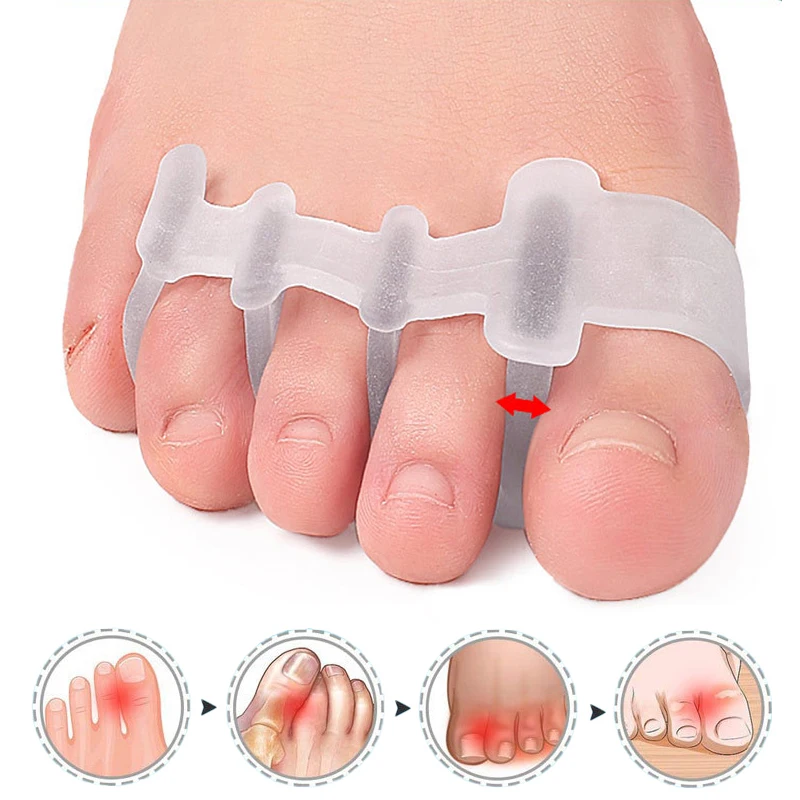כרית סיליקון ג 'ל הבוהן משטח המרווח וולקס valgus bununion אצבע מתקן האגודל splint מחליק straightener עבור שלפוחיות חופפות